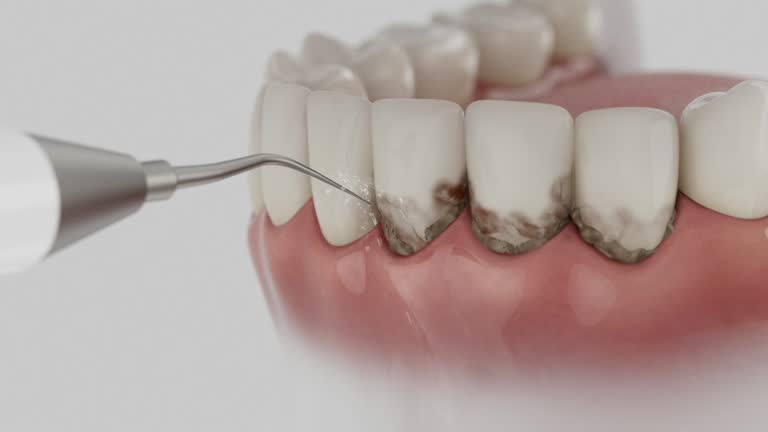 Reliable Dental Implants contractor in Ramona, CA by Smile Center Dentistry